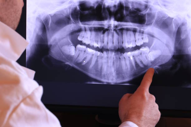 Best Emergency Gum Treatment in Columbia City, IN
