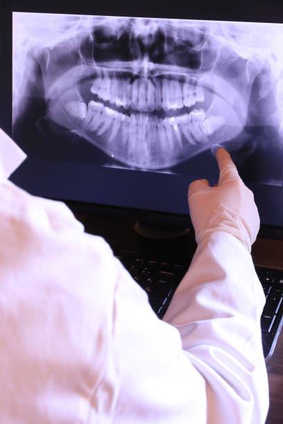 Best Emergency Dental Care for Broken or Chipped Teeth in Columbia City, IN